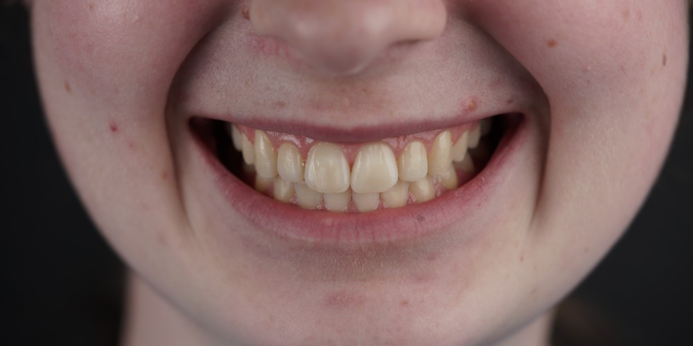 Smile Gallery | Watters Creek Dental | Allen, TX