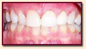 watters creek dental teeth