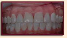 watters creek dental teeth